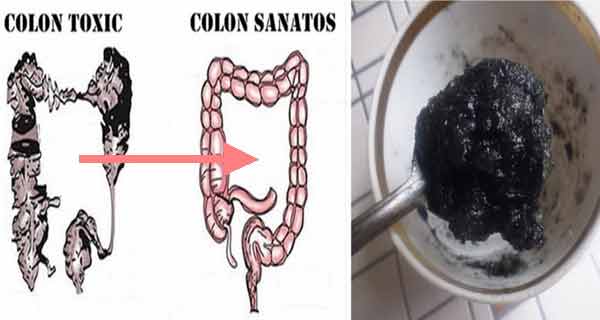 tratament detoxifiere colon