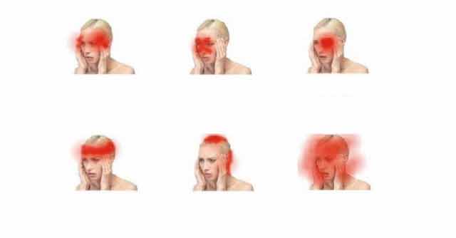 Dr. Ana Maria Ghitoiu - O clasificare a durerilor de cap include peste 150 de tipuri